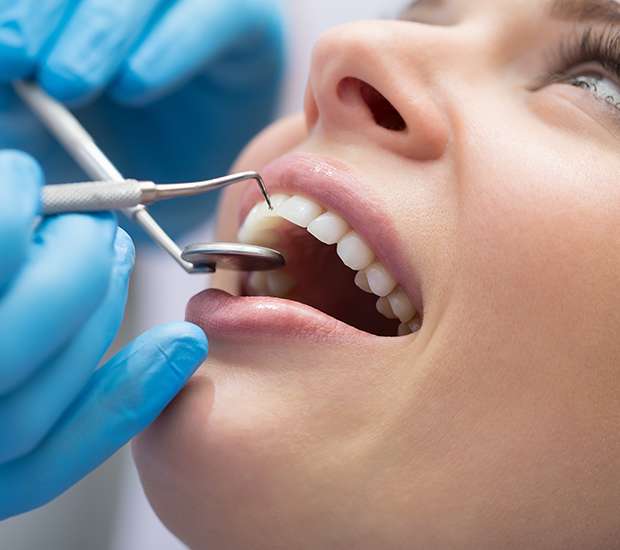 Chillicothe Dental Bonding