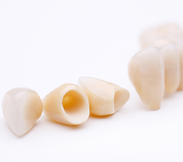 Chillicothe Dental Crowns and Dental Bridges
