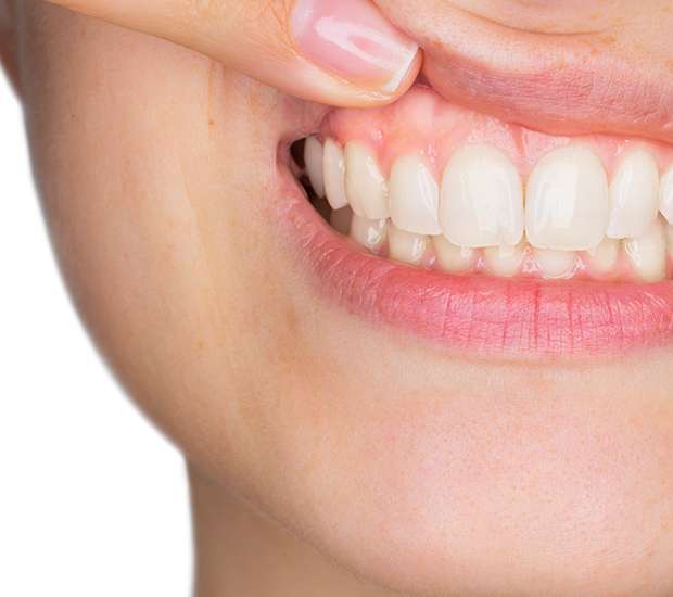 Chillicothe Gum Disease