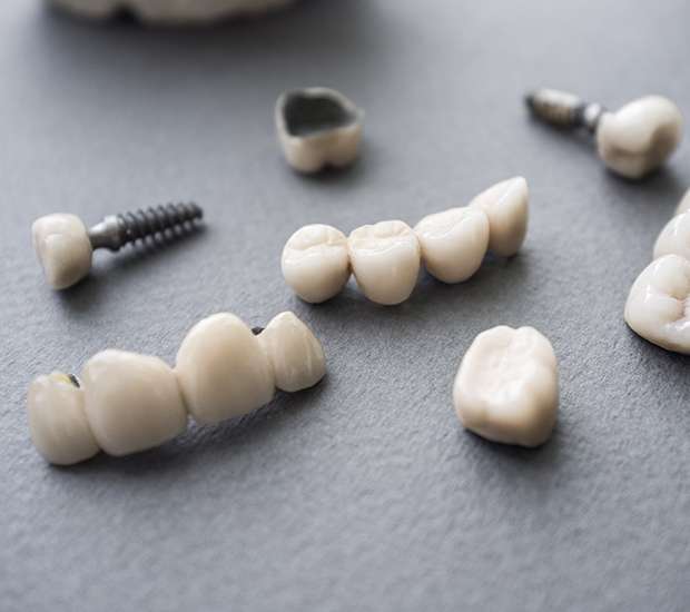 Chillicothe The Difference Between Dental Implants and Mini Dental Implants